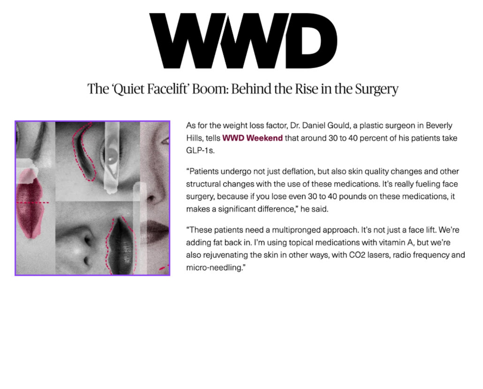 The ‘Quiet Facelift’ Boom: Behind the Rise in the Surgery