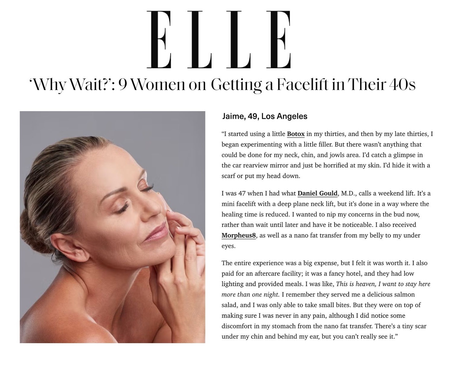 ‘Why Wait?’: 9 Women on Getting a Facelift in Their 40s