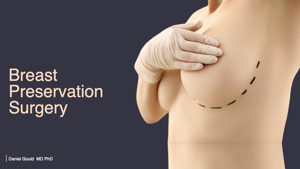 Breast Preservation Surgery Overview slide | Beverly Hills Plastic Surgery