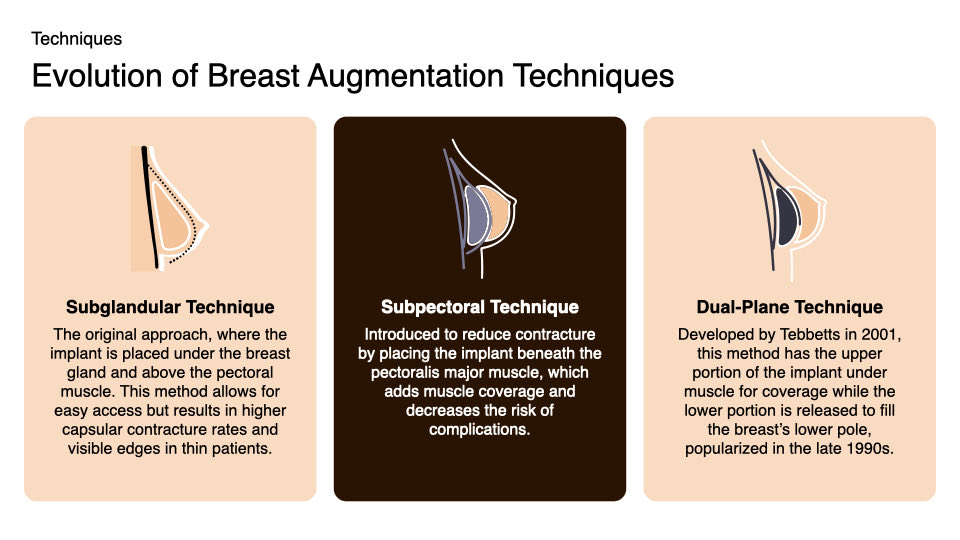 Breast Preservation Surgery Overview slide | Beverly Hills Plastic Surgery