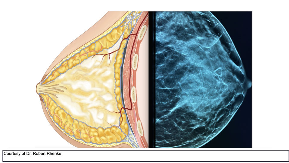 Breast Preservation Surgery Overview slide | Beverly Hills Plastic Surgery