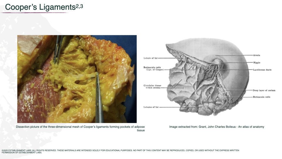 Breast Preservation Surgery Overview slide | Beverly Hills Plastic Surgery