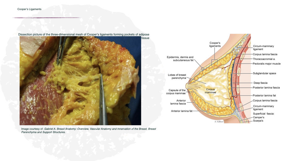 Breast Preservation Surgery Overview slide | Beverly Hills Plastic Surgery