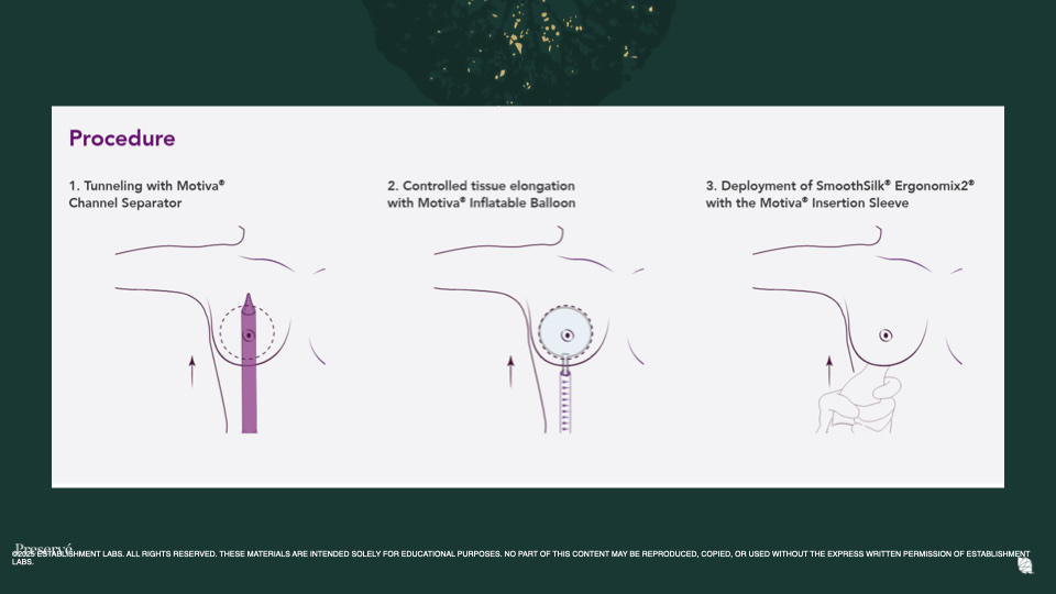 Breast Preservation Surgery Overview slide | Beverly Hills Plastic Surgery