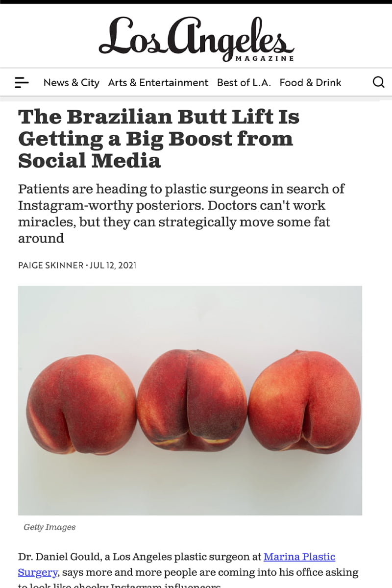 The Brazilian Butt Lift Is Getting a Big Boost from Social Media